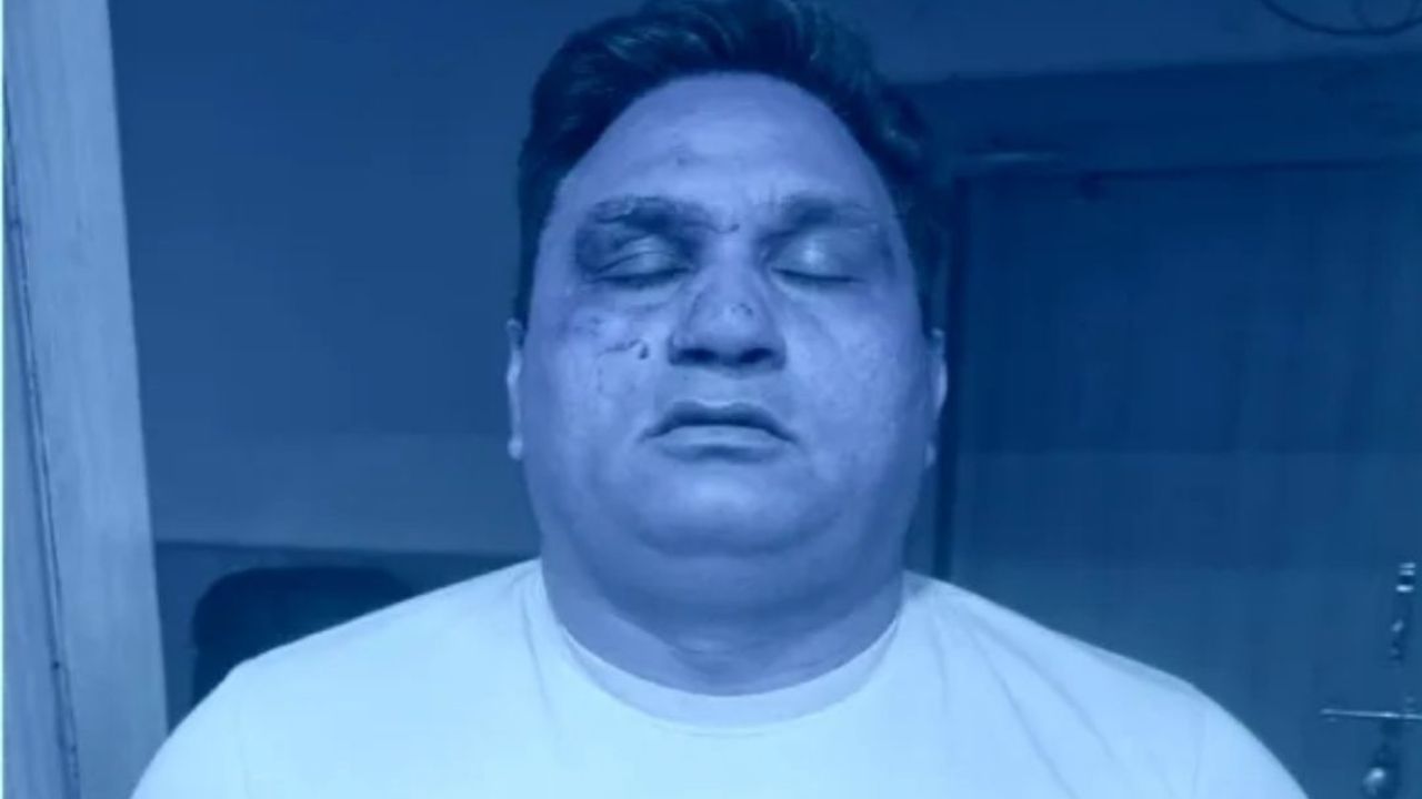 पुलिस टीम पर हमला करने वाले बदमाश गिरफ्तार वारदात में चौंकाने वाला मोड़